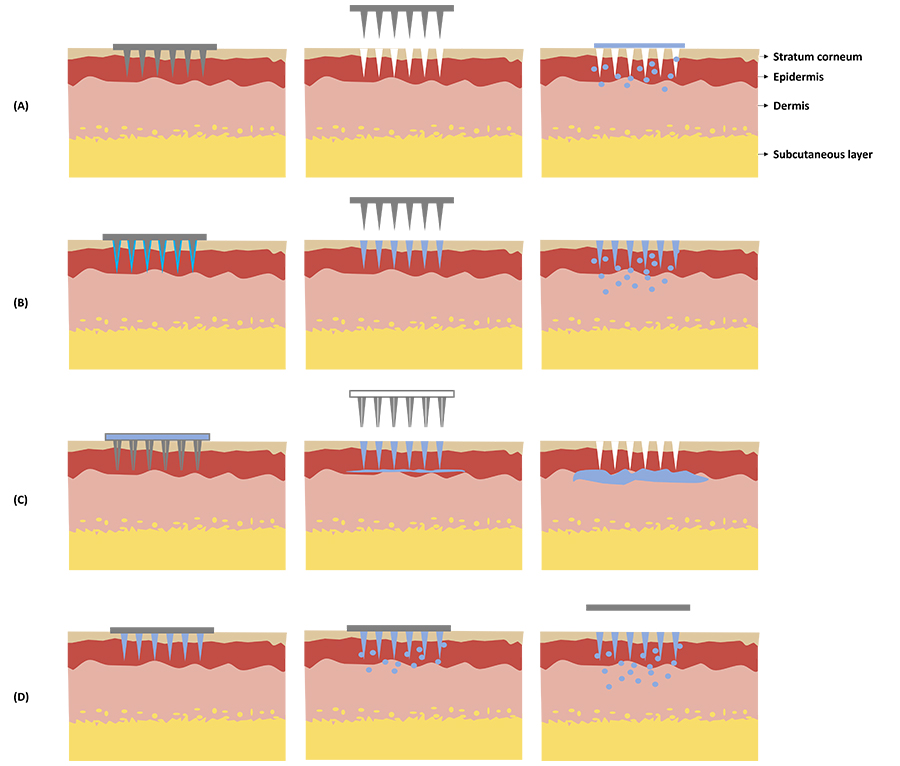 Types of Microneedle Array - CD Formulation