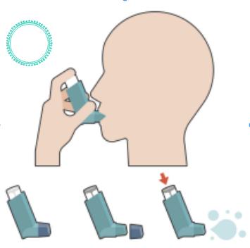 Liposome aerosol formulation.