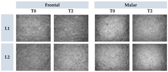 Fig.2 Representative images of cutaneous microrelief after application liposomes.