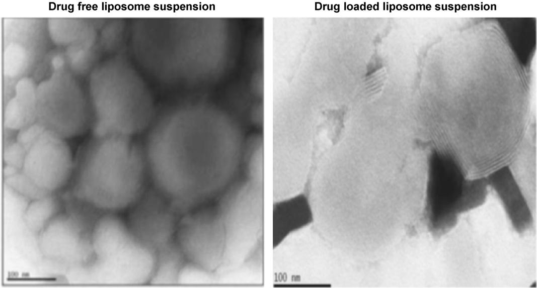 Fig.2 Transmission electron microscope images of liposome suspensions of non-drug and drug-containing liposomes.