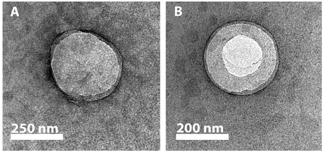 Fig.3 TEM image of the ultrasound responsive liposome.