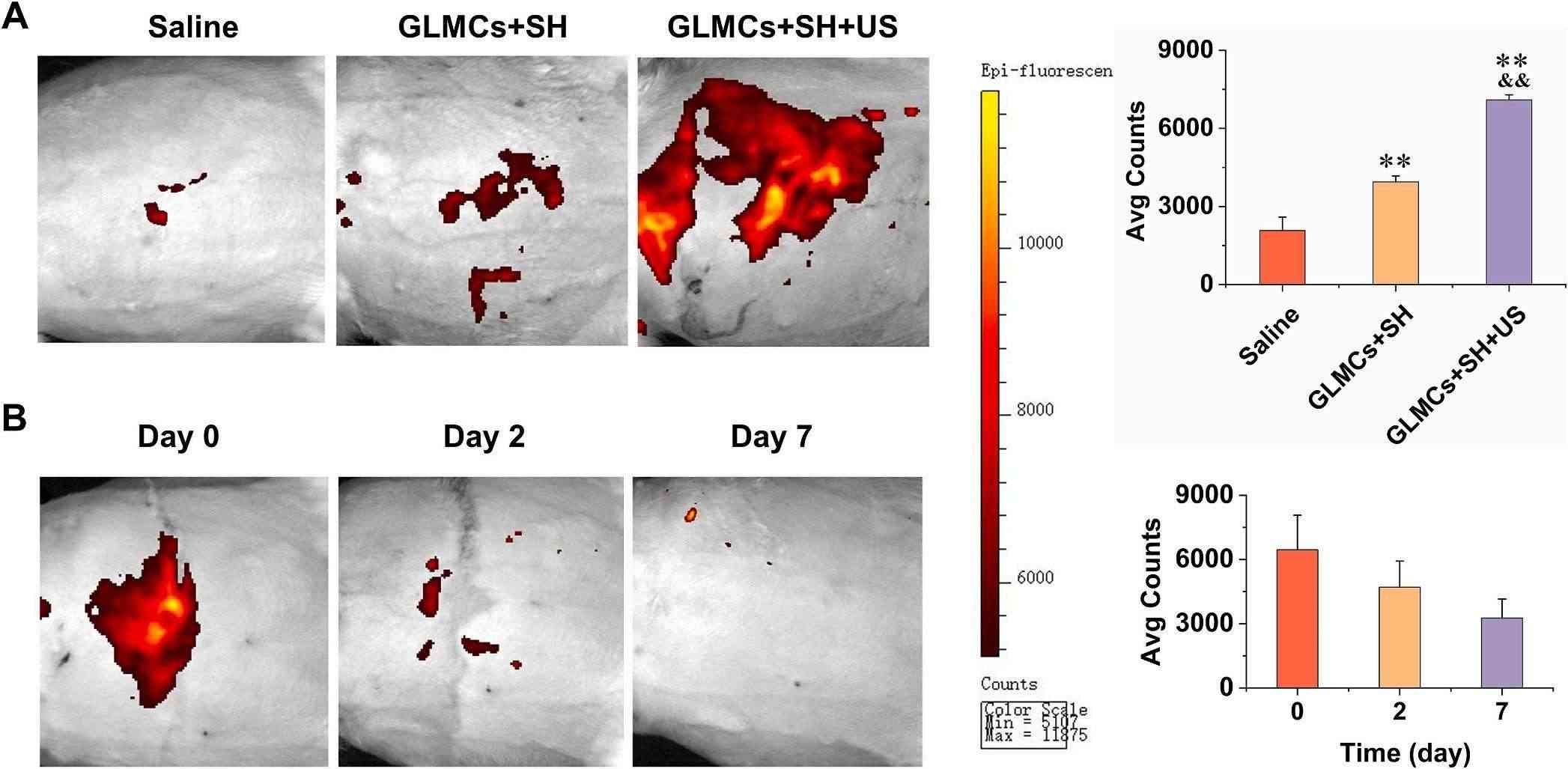 Fig.3 Tumor-targeted delivery of temperature/ultrasonic responsive liposome in rabbit.