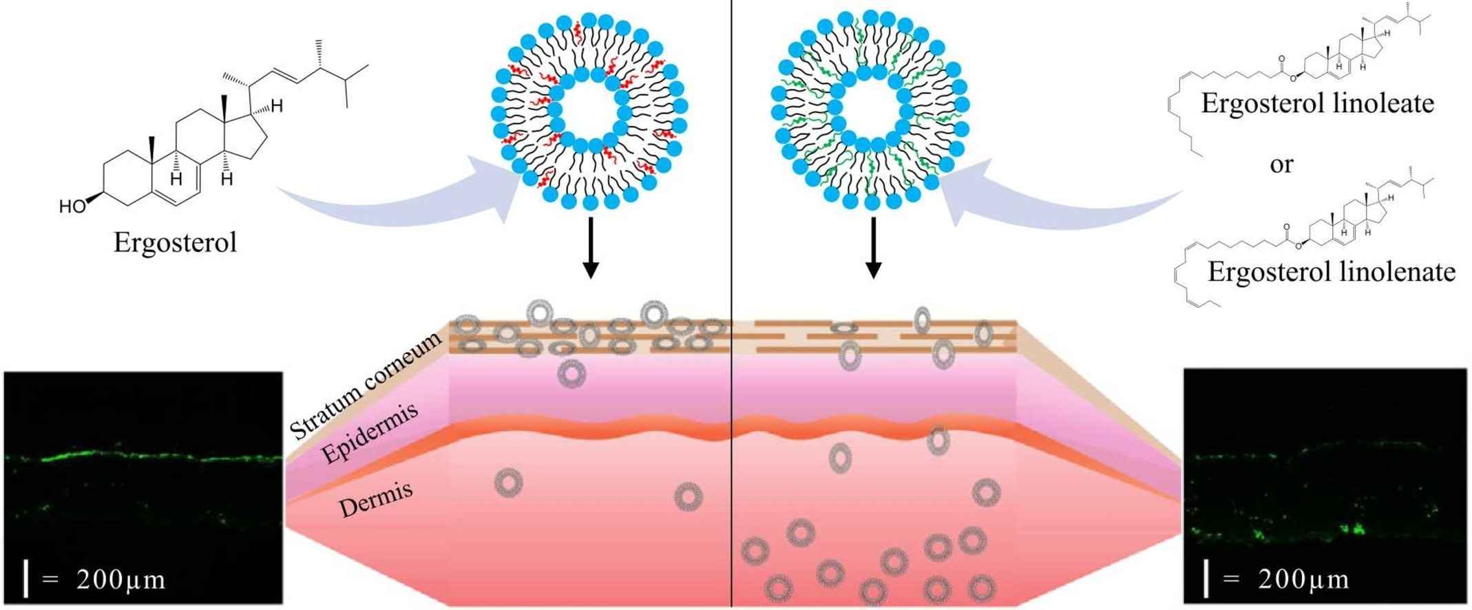 Fig. 2 Scheme of skin-permeable flexible liposomes.