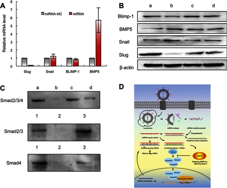 Fig.3 Functional microRNA liposomes inhibiting invasion and migration of TNBC cells.