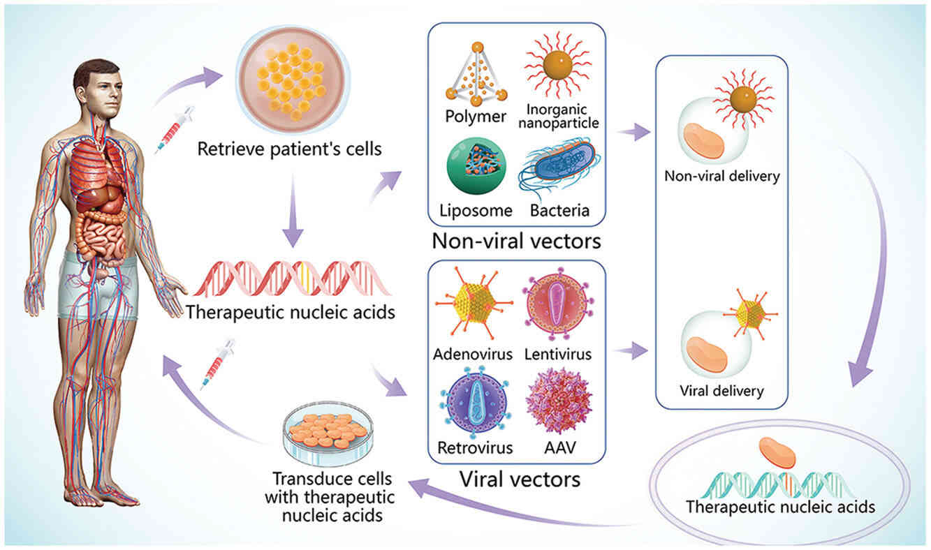 Fig.1 Overview of gene therapy strategies.