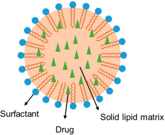 Fig.1 Structure of drug-loaded SLN particle.